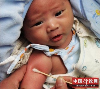 中国的婴幼儿现在可以免费接受转基因乙肝疫苗注射 中国的婴幼儿现在可以免费接受转基因乙肝疫苗注射